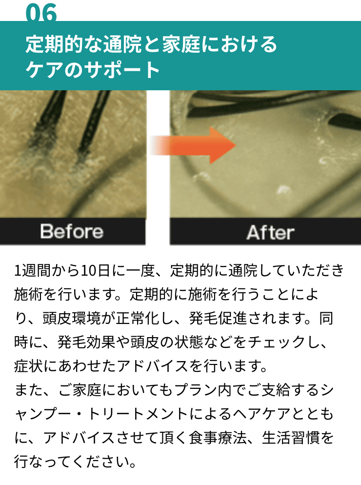 定期的な通院と家庭における
ケアのサポート