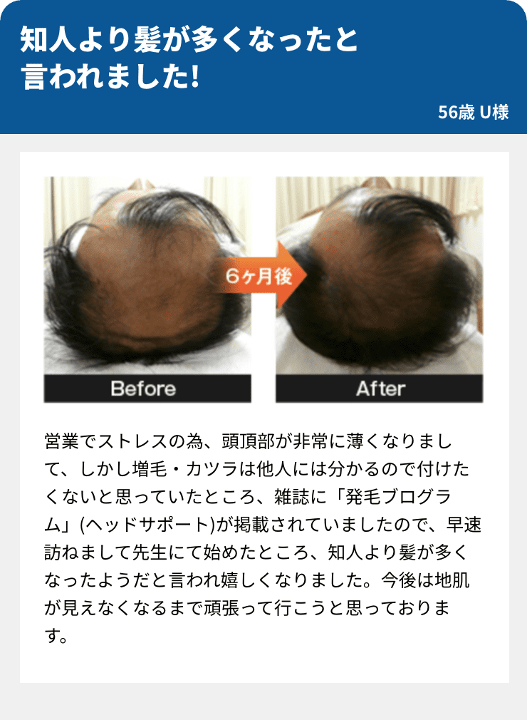 知人より髪が多くなったと
言われました!