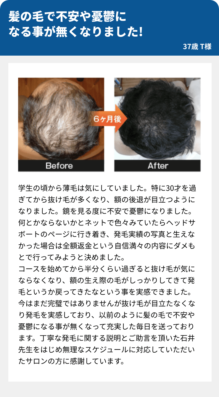 髪の毛で不安や憂鬱に
なる事が無くなりました!