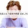 びまん性脱毛症とは？症状や原因【治し方と治療期間】