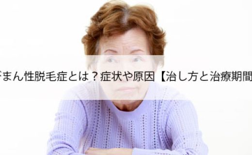 びまん性脱毛症とは？症状や原因【治し方と治療期間】