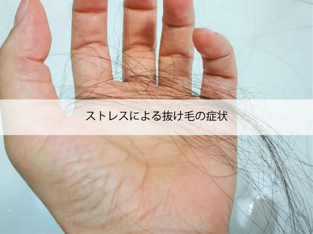 ストレスによる抜け毛の症状