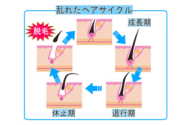 乱れたヘアサイクル