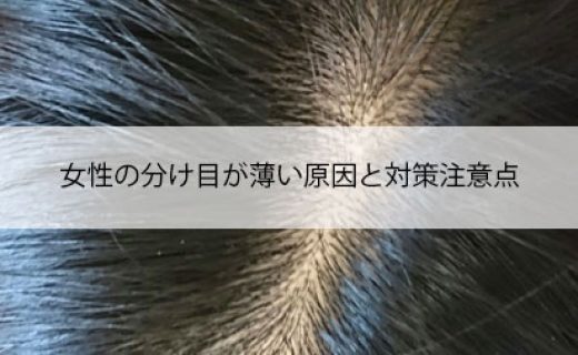 女性の分け目が薄い原因と対策注意点