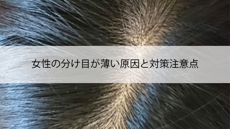 女性の分け目が薄い原因と対策注意点