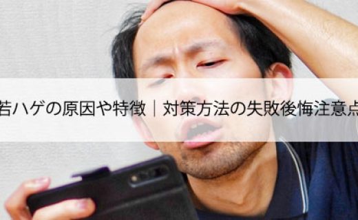 若ハゲの原因や特徴｜対策方法の失敗後悔注意点