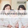 女性や子どもの円形脱毛症対処法と注意点