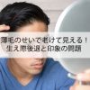 薄毛のせいで老けて見える！生え際後退と印象の問題