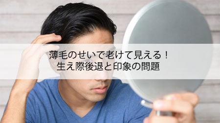 薄毛のせいで老けて見える！生え際後退と印象の問題