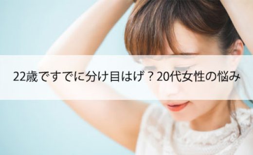 22歳ですでに分け目はげ？20代女性の悩み