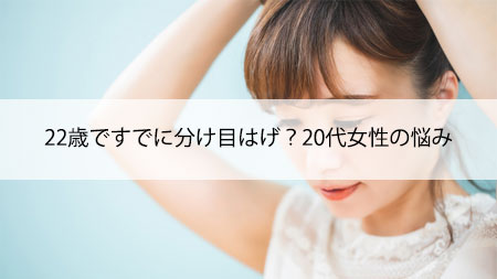 22歳ですでに分け目はげ？20代女性の悩み