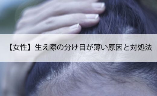 【女性】生え際の分け目が薄い原因と対処法