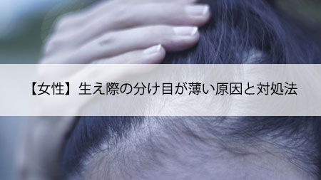 【女性】生え際の分け目が薄い原因と対処法