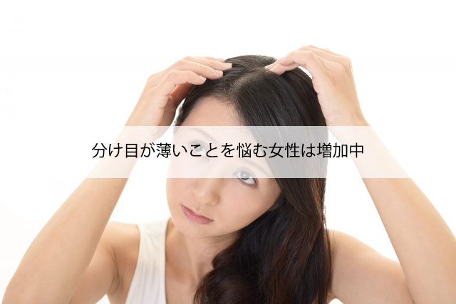 分け目が薄いことを悩む女性は増加中