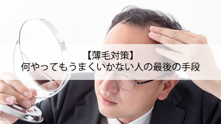 【薄毛対策】何やってもうまくいかない人の最後の手段