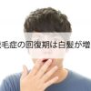 円形脱毛症の回復期には白髪が増える？