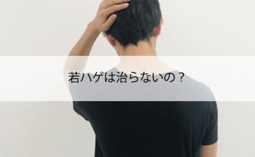 若ハゲは治らないの？