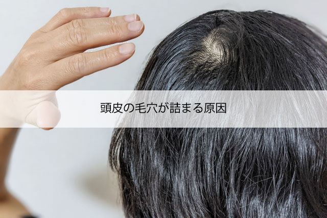 頭皮の毛穴が詰まる原因